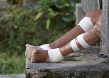 야생동물 ‘아르마딜로’를 애완용으로? … “한센병 발병 높인다”