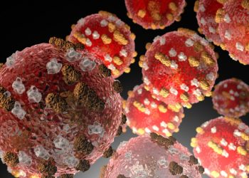 여전히 확산중인 홍역, 총 717건 … 달라스 첫 확진 2건, 휴스턴 폐수에서 바이러스 검출