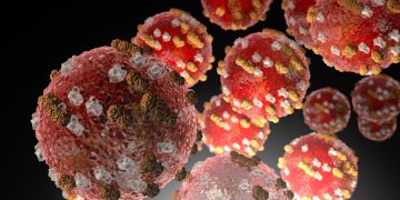 여전히 확산중인 홍역, 총 717건 … 달라스 첫 확진 2건, 휴스턴 폐수에서 바이러스 검출